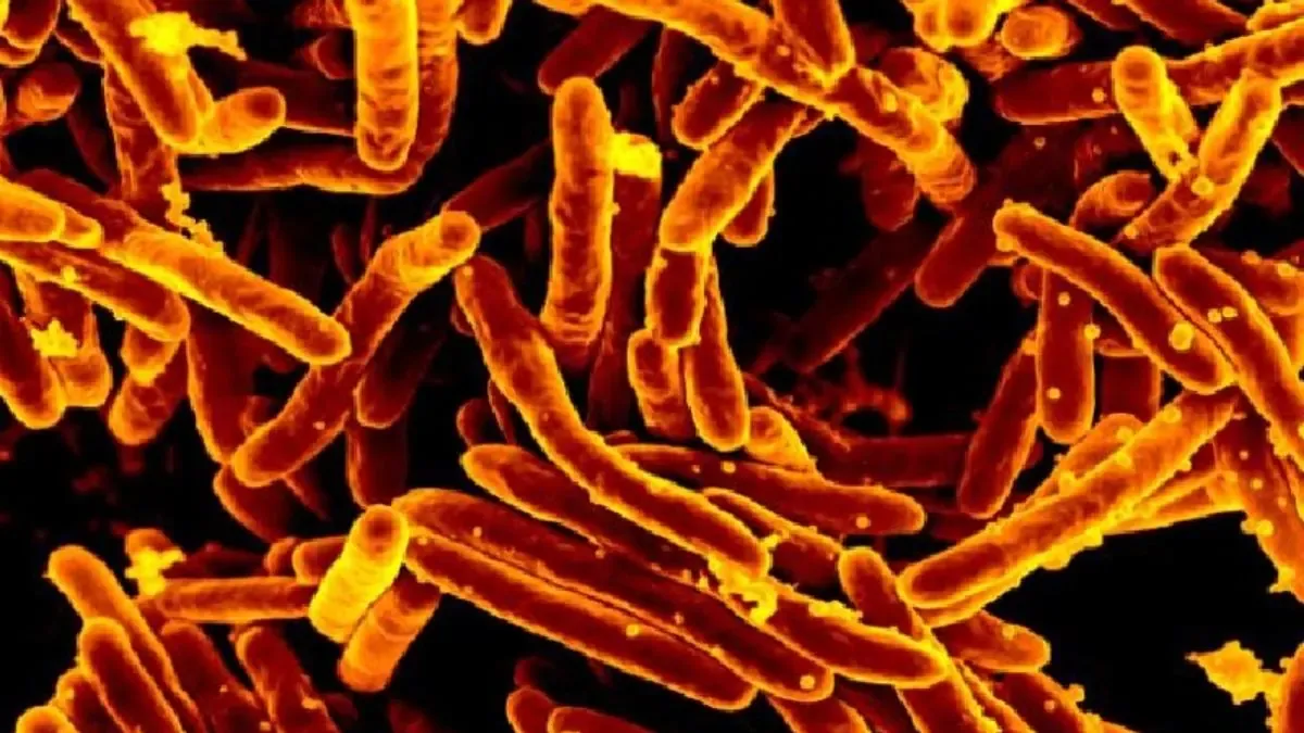 ¡Alerta en Badajoz! Brote de tuberculosis sacude un colegio y preocupa a padres